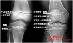  这个部位决定孩子长多高，错过补不回！